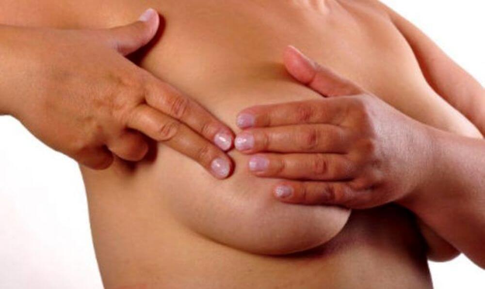 Nunez Health Breast Exam